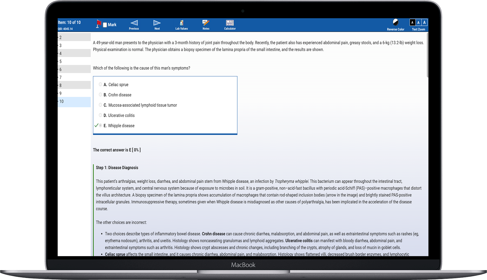 Screenshot of Qmax assessment when faculty is editing